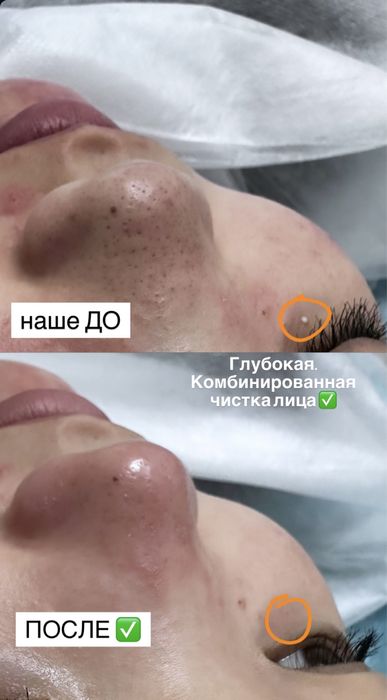 Курс косметолога-эстета 150 000тг