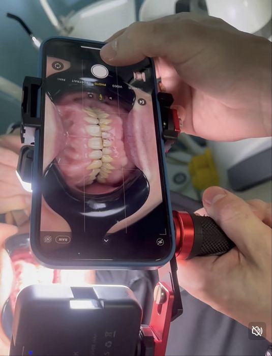 MKT-016 для дентальной фотографии