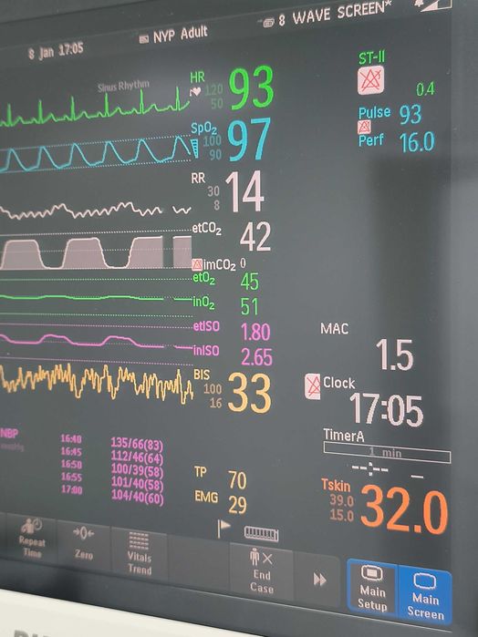 Монитор пациента Philips IntelliVue MP70 anesthesia