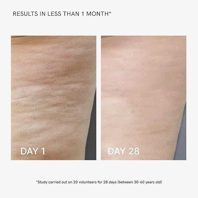 MASDERM радиочестотен апарат за тяло, антицелулитен масажор с EMS LED