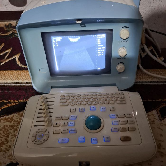 Ultratovush tekshiruvi aparati UZI I