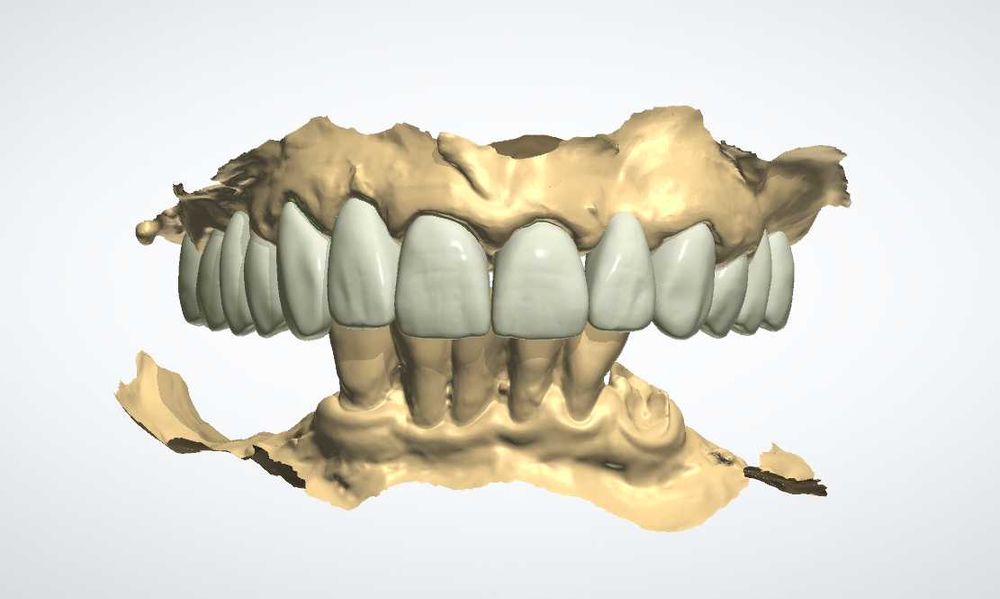 CAD/CAM дизайн |Корони, мостове, барове| 3Shape | Blender for Dental |