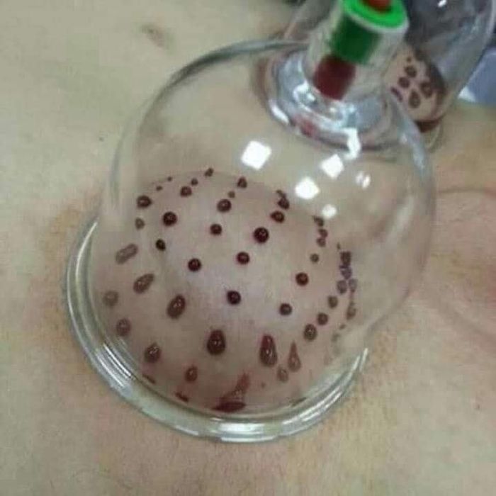 Xidjama faqat ayollar uchun