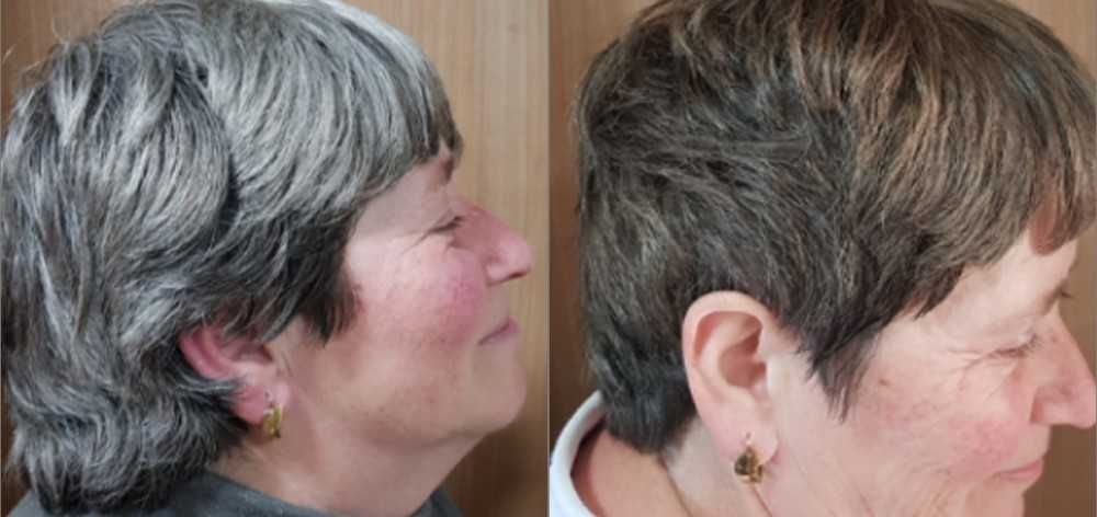 Tratament nat. pt. repigmentarea parului carunt, GR-7 Professional GR7