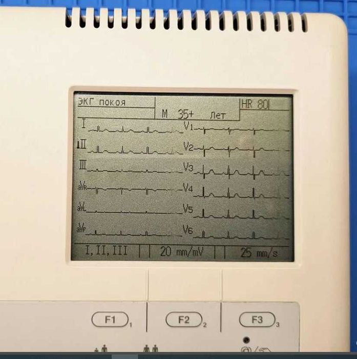 Электрокардиограф Nihon Kohden CARDIOFAX GEM ECG-9620