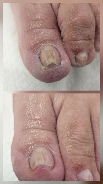 Pedichiură clasică și medicală