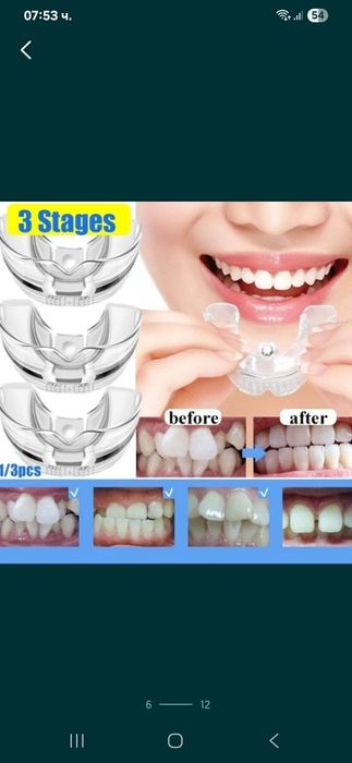 Ортодонтски коректор,шини,алайнер на зъби брекети зъбен фиксатор
Невид