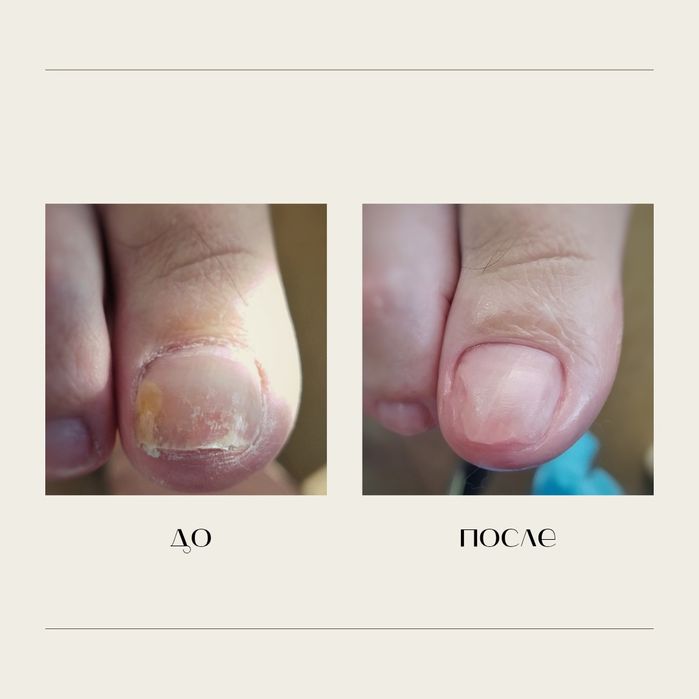 Педикюр, подолог