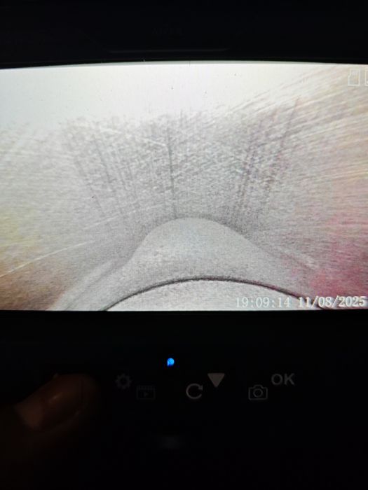 Эндаскопия подбор двигателя