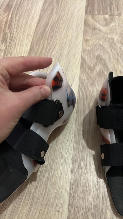 Ортезы для лечения вальгуса