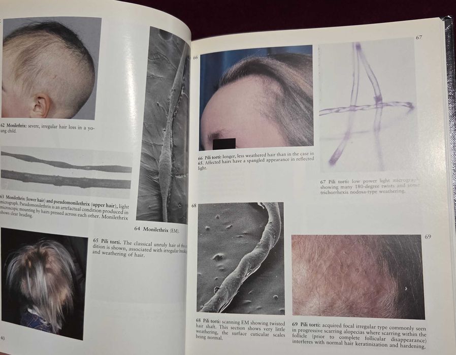 A Colour Atlas of the Hair, Scalp and Nails
