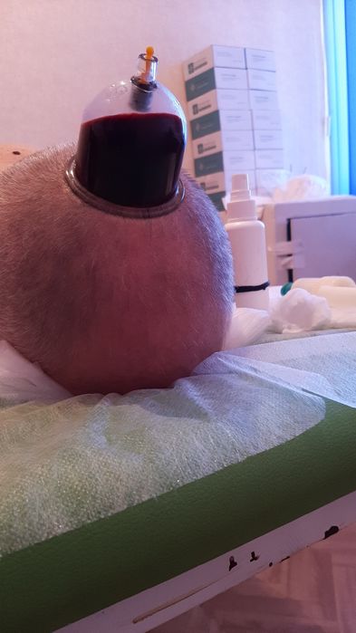 Хиджама в Караганде. Лечение, профилактика. Обучение Хиджаме