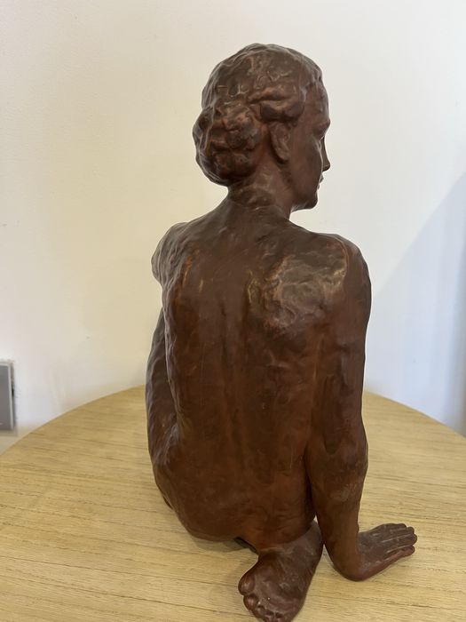 Авторска пластика