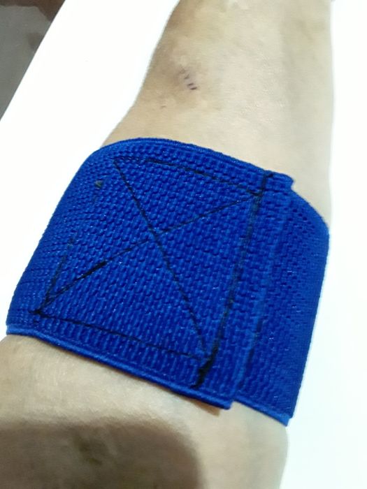 Закрепляющие манжеты на руку.