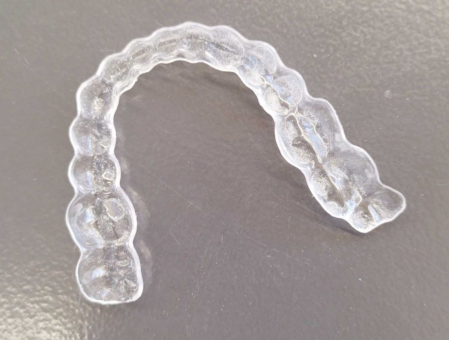 Професионална изработка на ретайнери, шини за избелване и бруксизъм