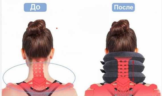 Надувной воротник для шеи