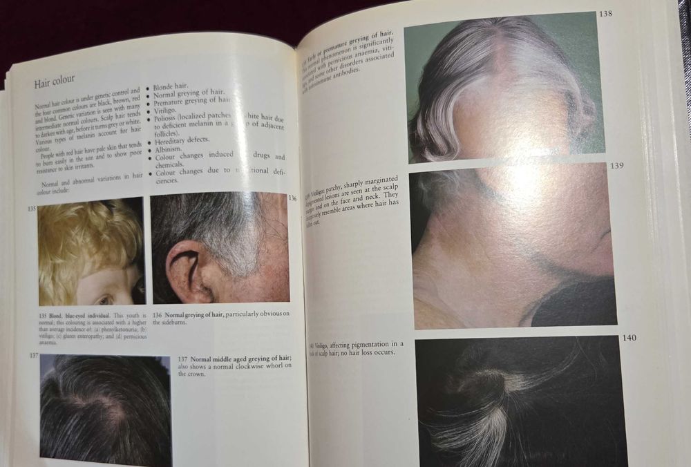 A Colour Atlas of the Hair, Scalp and Nails