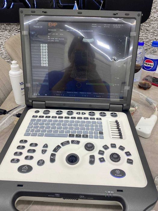Портативный УЗИ аппарат EMP G30