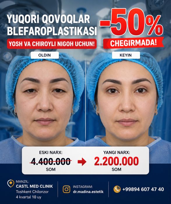-50% CHEGIRMADA Blefaroplastika