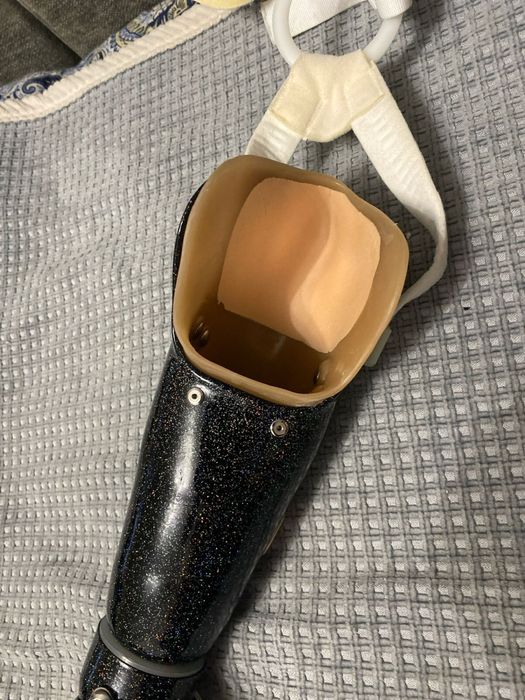 продам бионический протез