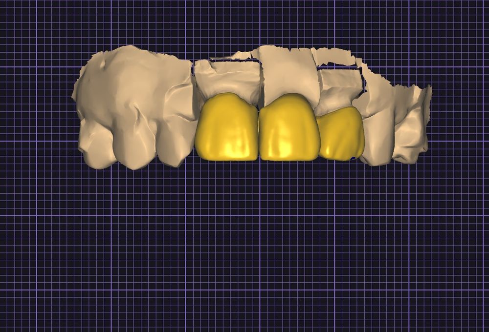 Практика для зубных техников