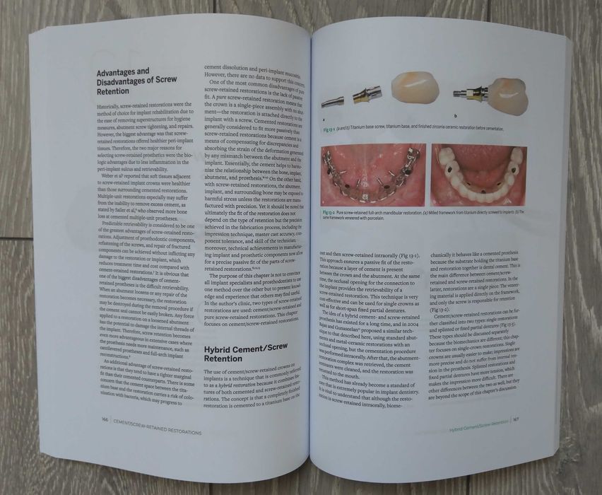 Zero Bone Loss Concepts - Tomas Linkevicius 2019