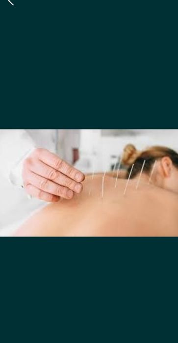 Курсы, обучение Иглотерапии, хиджаме
