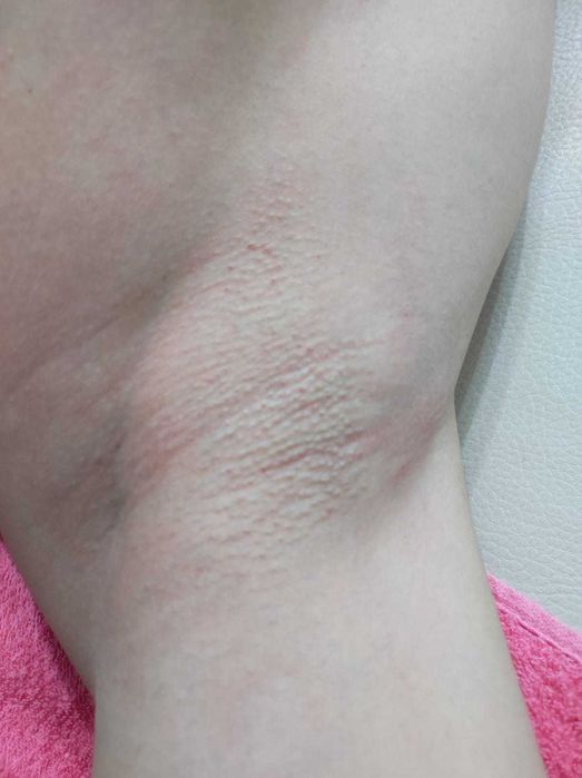 Шугаринг/Талдыкорган