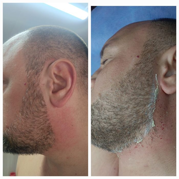 Депиляция г. АЛМАТЫ