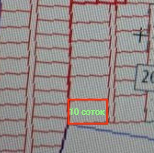 Продам участки по 10соток