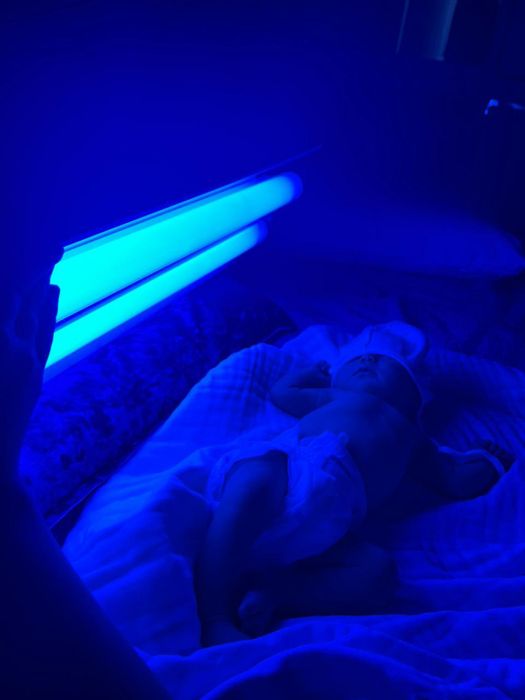 Лампа баланың сарысына