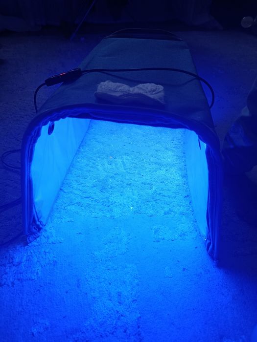 Фотолампа от желтушок