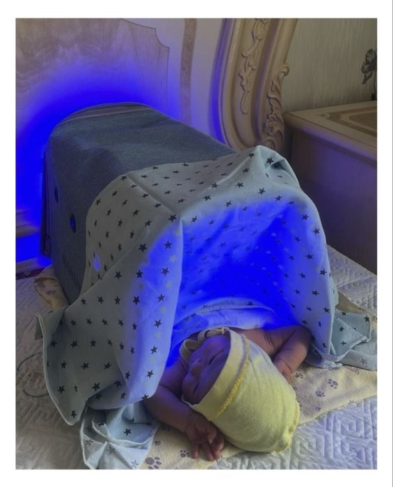 Аренда фотолампа от желтухи, лампа, фотолампа, прокат фотолампы
