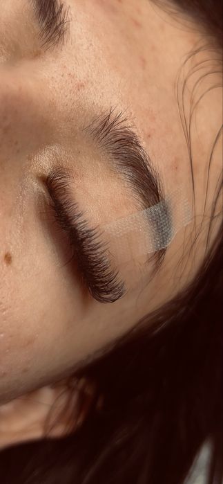 Extensii gene/Laminare