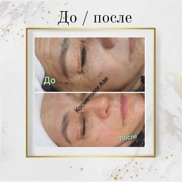 Косметолог хизмати