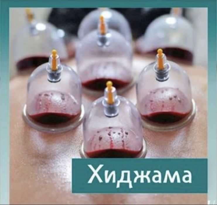 Шертпе Хиджама Омыртқа дұрыстау Орталығы