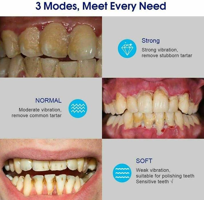 iFanze Комплект за почистване на зъби