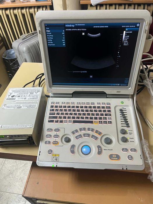 Продавам пеносим ехограф Mindray Z5 и графичен принтер Mitsubishi P93W