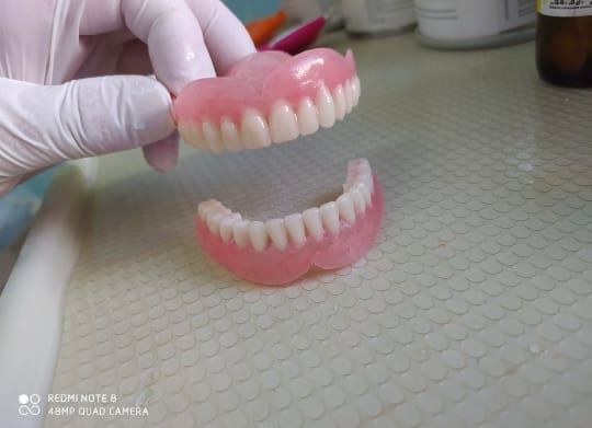 Сьемные зубные протезы быстро и качественно