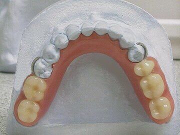 Сьемные протезы!