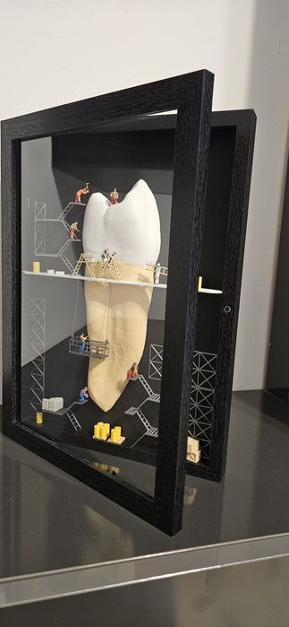 DENTAL ART – Sculpting Precision