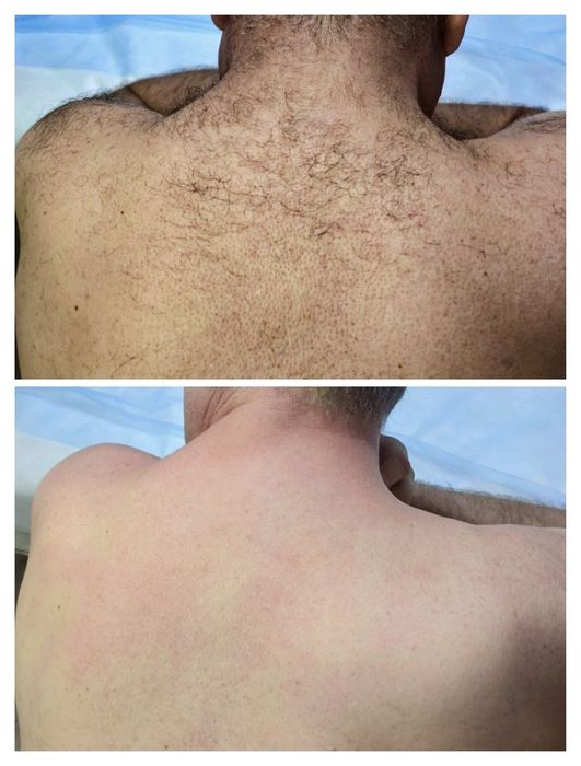 ШУГАРИНГ для всех