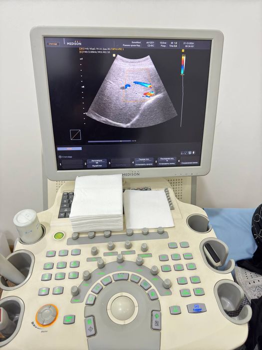 Узи сотилади  медиссон