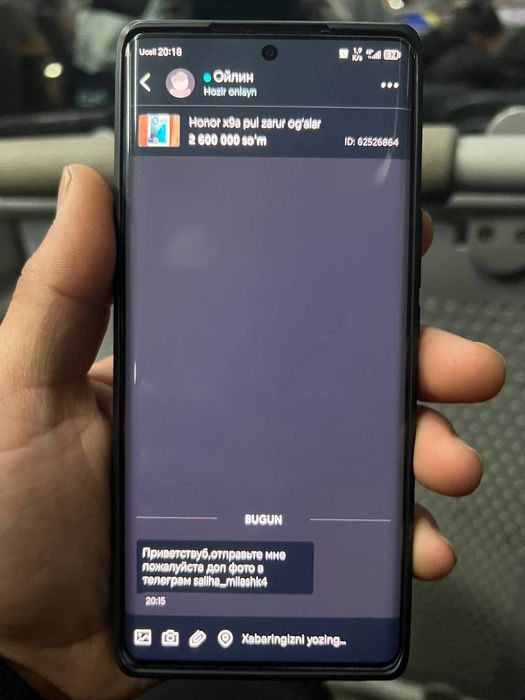 Honor x9a holati zo'r