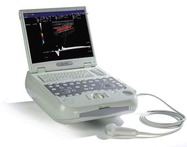 Uzi portativ apart. Samsung medison mysono u 6