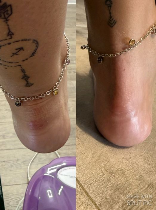 Terapie de relaxare Fish Spa