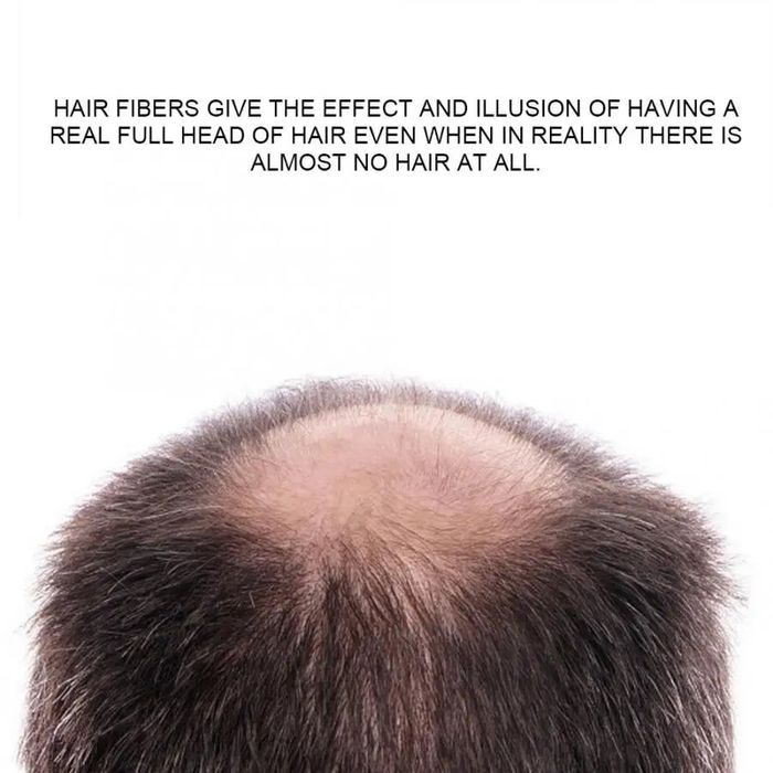 Дермозоллер,соч соқол чиқариш,soch soqol,dermozeller,10%