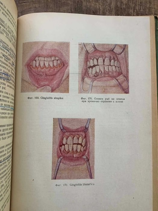 Терапевтична стоматология-Димитър Свраков