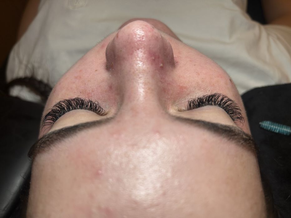 Extensii gene (1D, 2D, 3D, 4D)