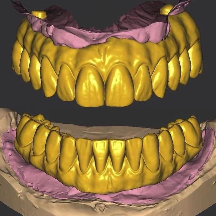 Exocad CAD/CAM | Zirkoniya va PMMA 3D modellar